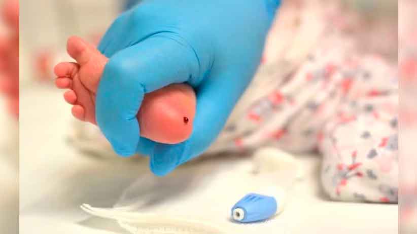 Capacita Secretaría de Salud a personal de enfermería para la realización del Tamiz Neonatal Metabólico y Auditivo